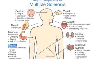 Managing Multiple Sclerosis With Massage