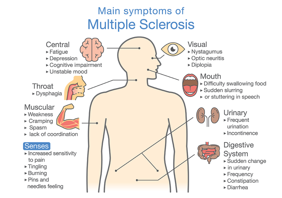 Managing Multiple Sclerosis With Massage